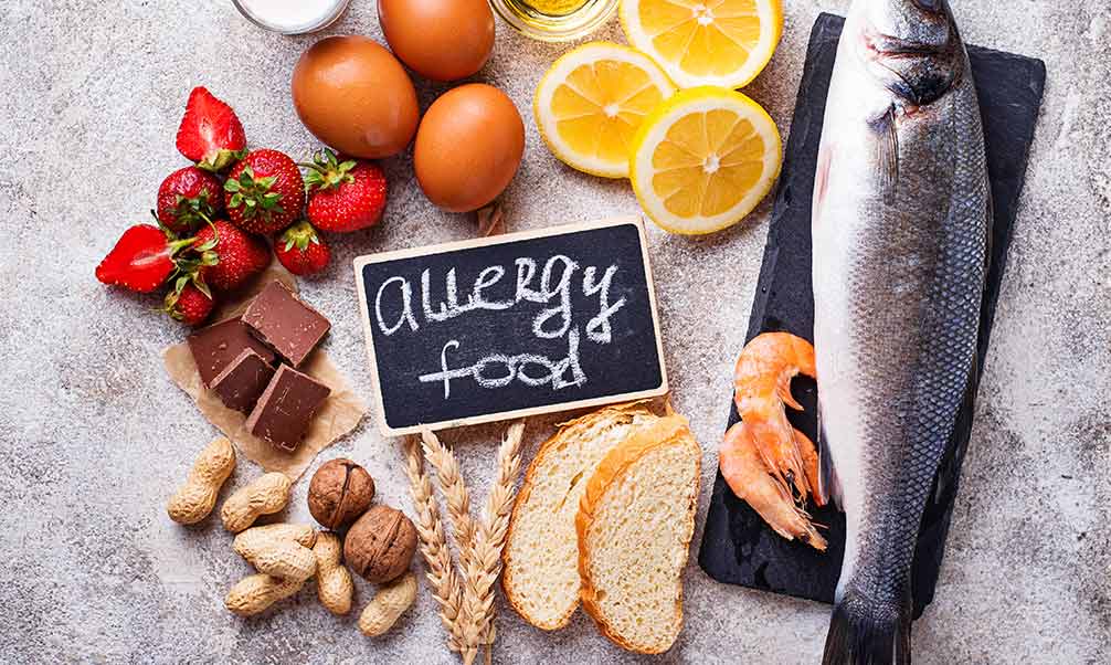 Codificación por colores de la cocina de tu restaurante según tipo de alimento